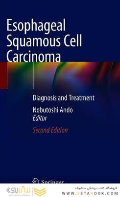 Esophageal Squamous Cell Carcinoma : Diagnosis and Treatment