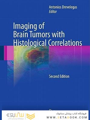Imaging of Brain Tumors with Histological Correlations2011