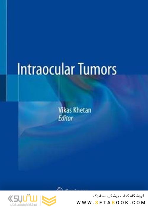 Intraocular Tumorsتومورهای داخل چشمی
