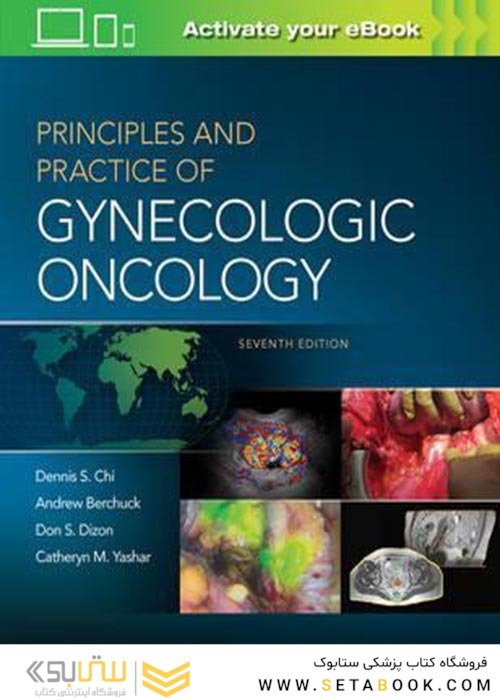 Principles and Practice of Gynecologic Oncology