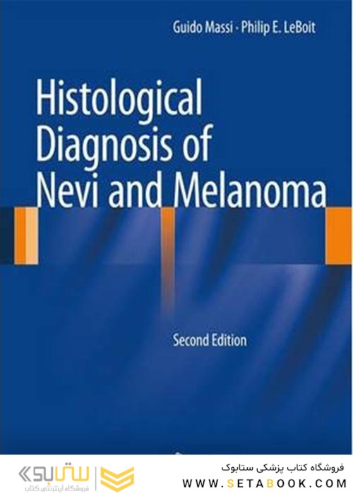 Histological Diagnosis of Nevi and Melanomaتشخیص بافتی خال ها و ملانوم