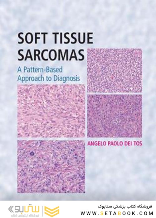 Soft Tissue Sarcomas Hardback with Online Resource : A Pattern-Based Approach to Diagnosisسارکومهای بافت نرم