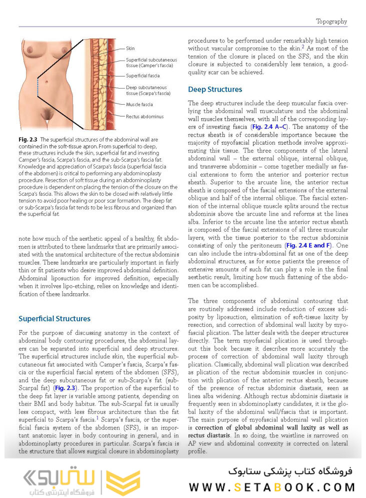Atlas of Abdominoplasty
