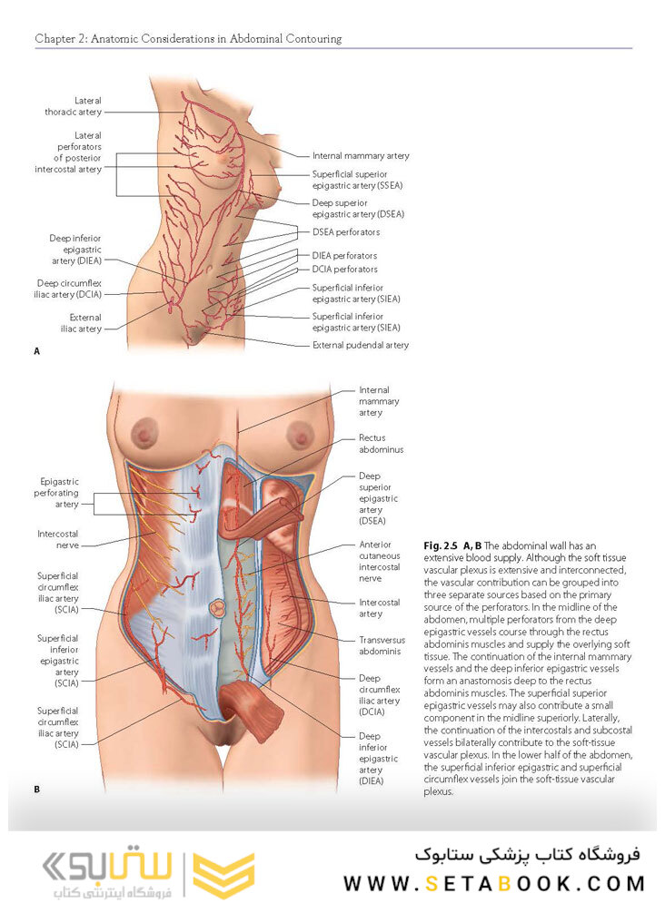 Atlas of Abdominoplasty