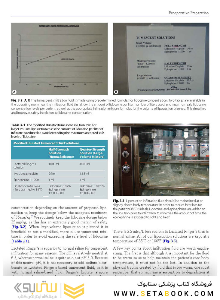 Atlas of Abdominoplasty