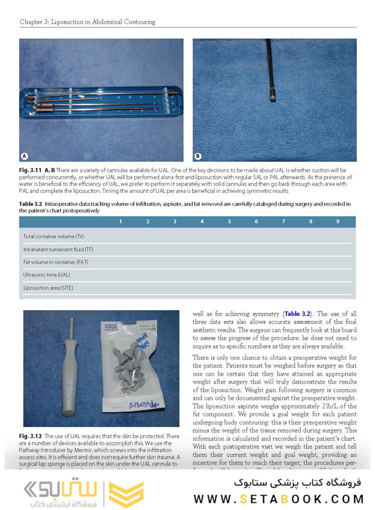Atlas of Abdominoplasty
