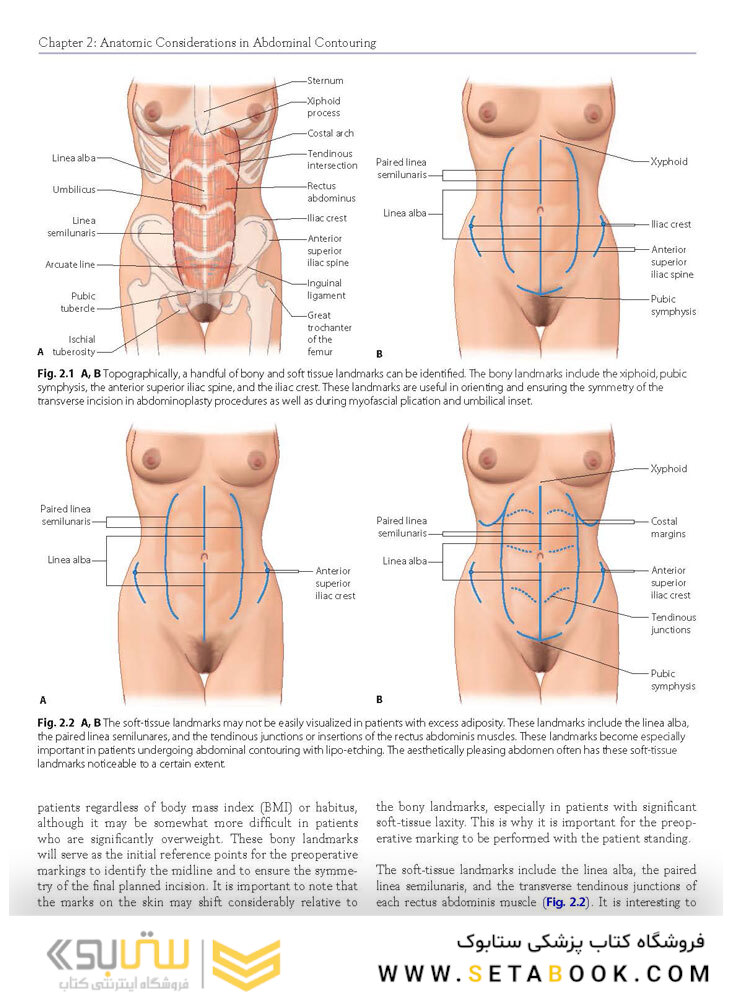 Atlas of Abdominoplasty