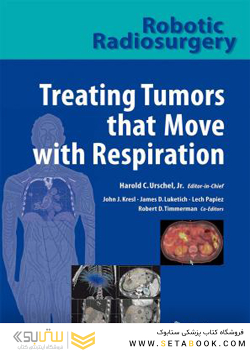 جراحی رادیویی درمان تومورهایی که با تنفس حرکت می کنند