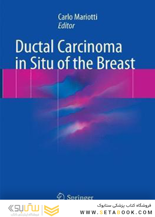 سرطان مجاری در وضعیت سینه