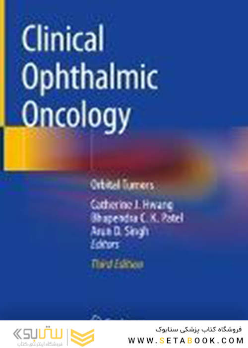 آنکولوژی بالینی چشم پزشکی