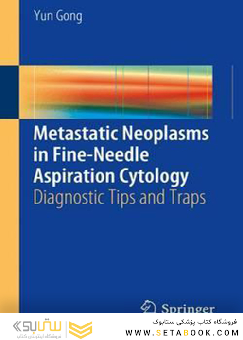 نئوپلاسم های متاستاتیک در سیتولوژی آسپیراسیون با سوزن ظریف