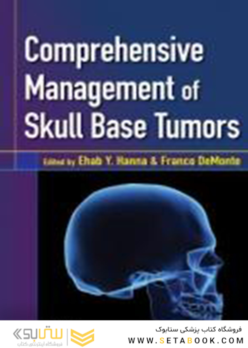 مدیریت جامع تومورهای پایه جمجمه
