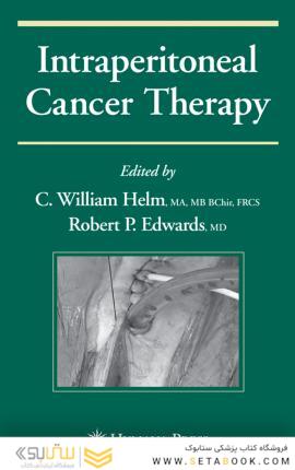 درمان سرطان داخل صفاقی