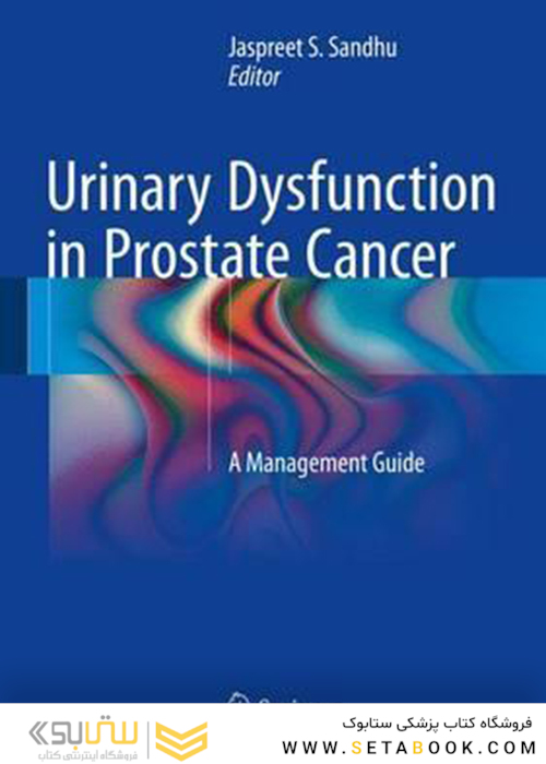 اختلال ادراری در سرطان پروستات