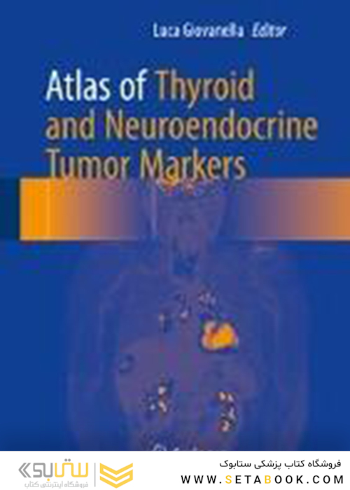 اطلس نشانگرهای تومور تیروئید و نوروآندوکرین