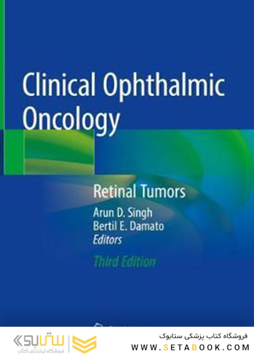 آنکولوژی بالینی چشم