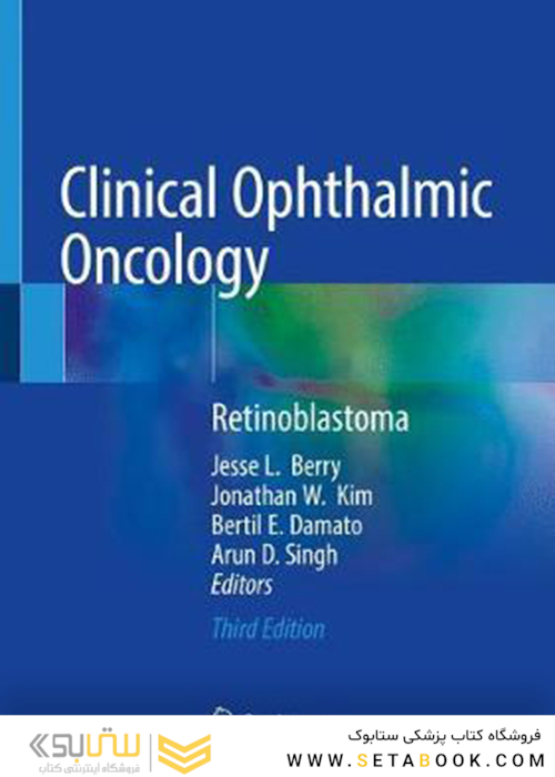 آنکولوژی بالینی چشم: رتینوبلاستوما
