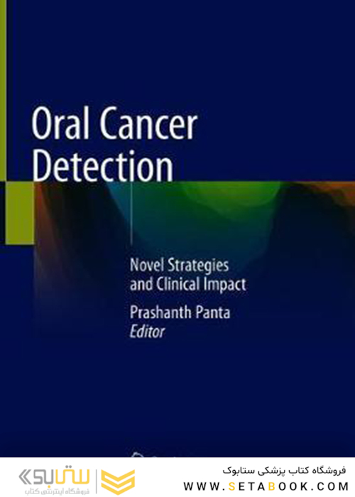 تشخیص سرطان دهان
