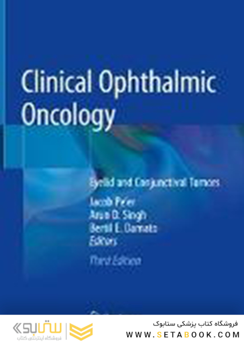 انکولوژی چشم پزشکی بالینی
