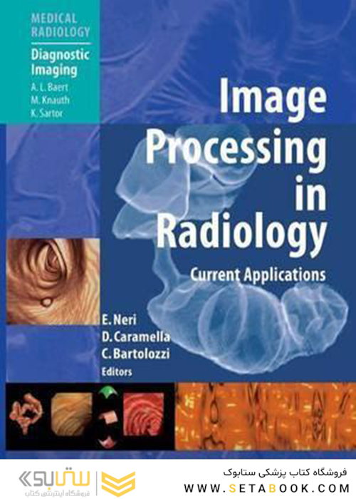 پردازش تصویر در رادیولوژی