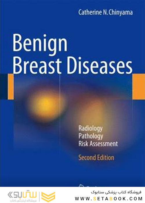 بیماری های پستان خوش خیم