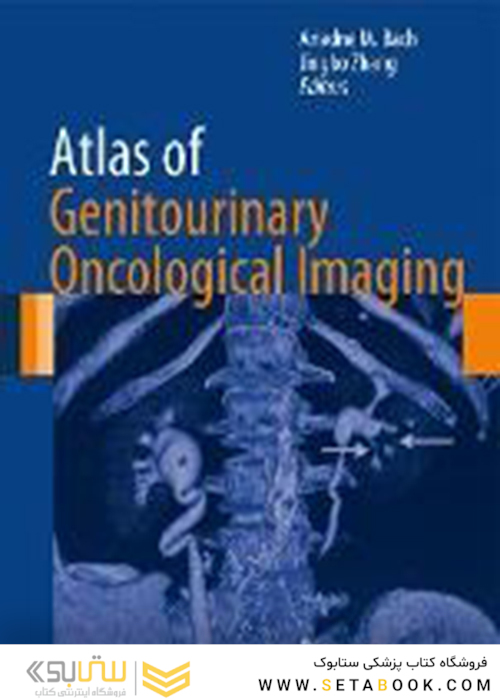 Atlas of Genitourinary Oncological Imaging