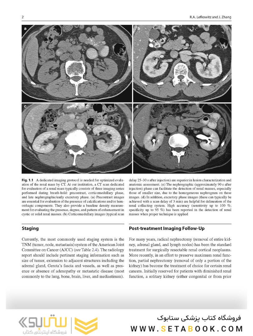 Atlas of Genitourinary Oncological Imaging