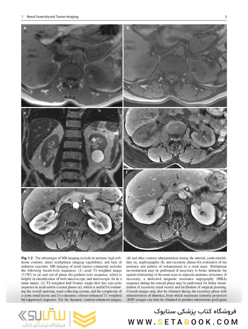 Atlas of Genitourinary Oncological Imaging