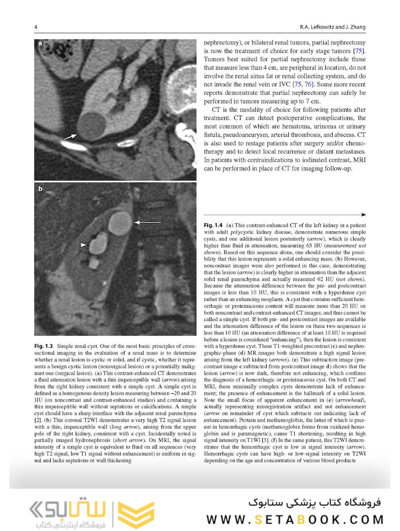 Atlas of Genitourinary Oncological Imaging
