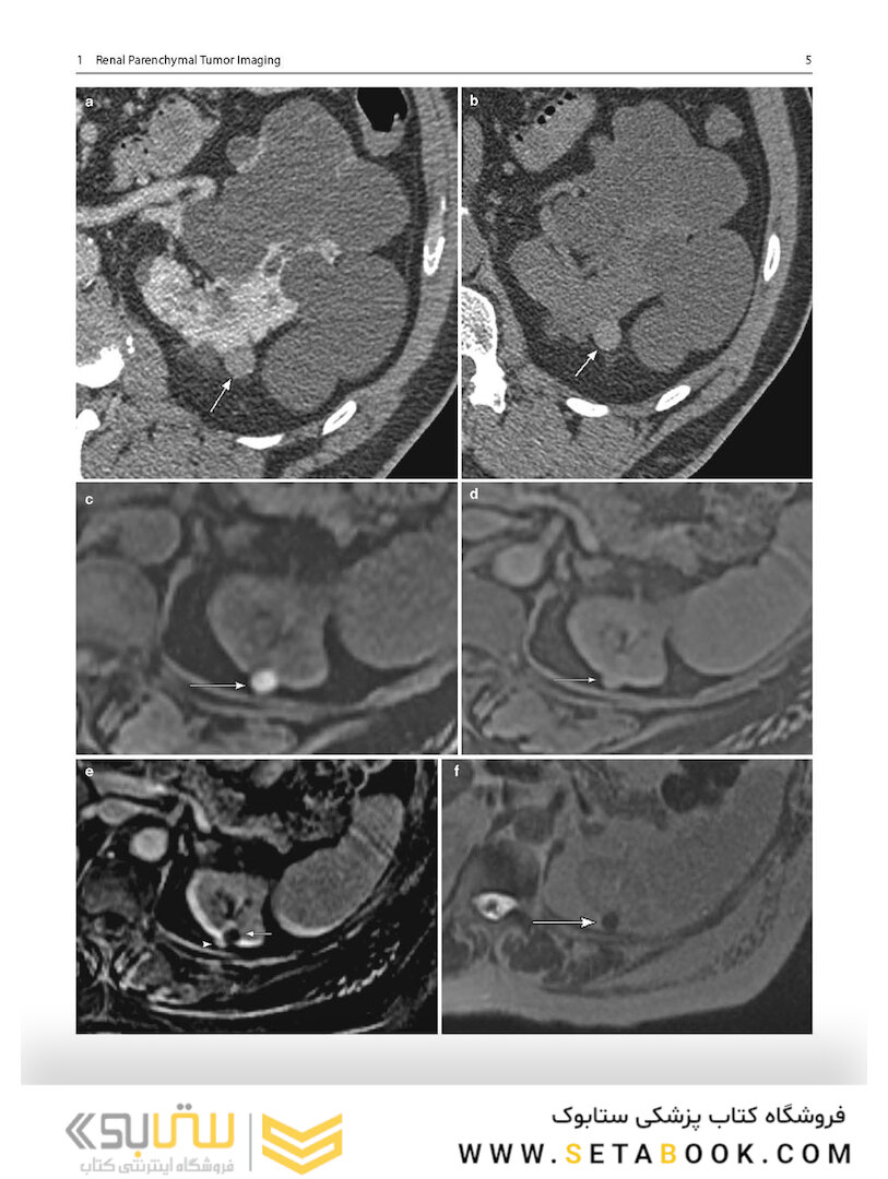 Atlas of Genitourinary Oncological Imaging