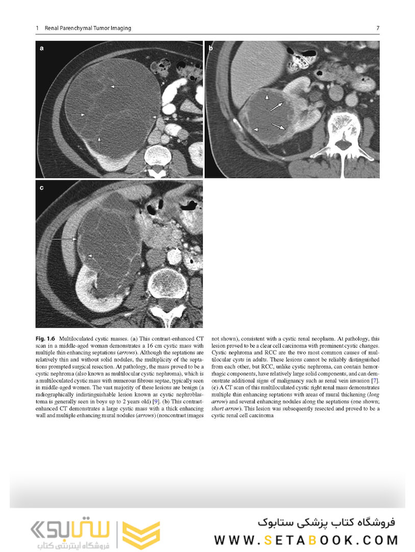 Atlas of Genitourinary Oncological Imaging