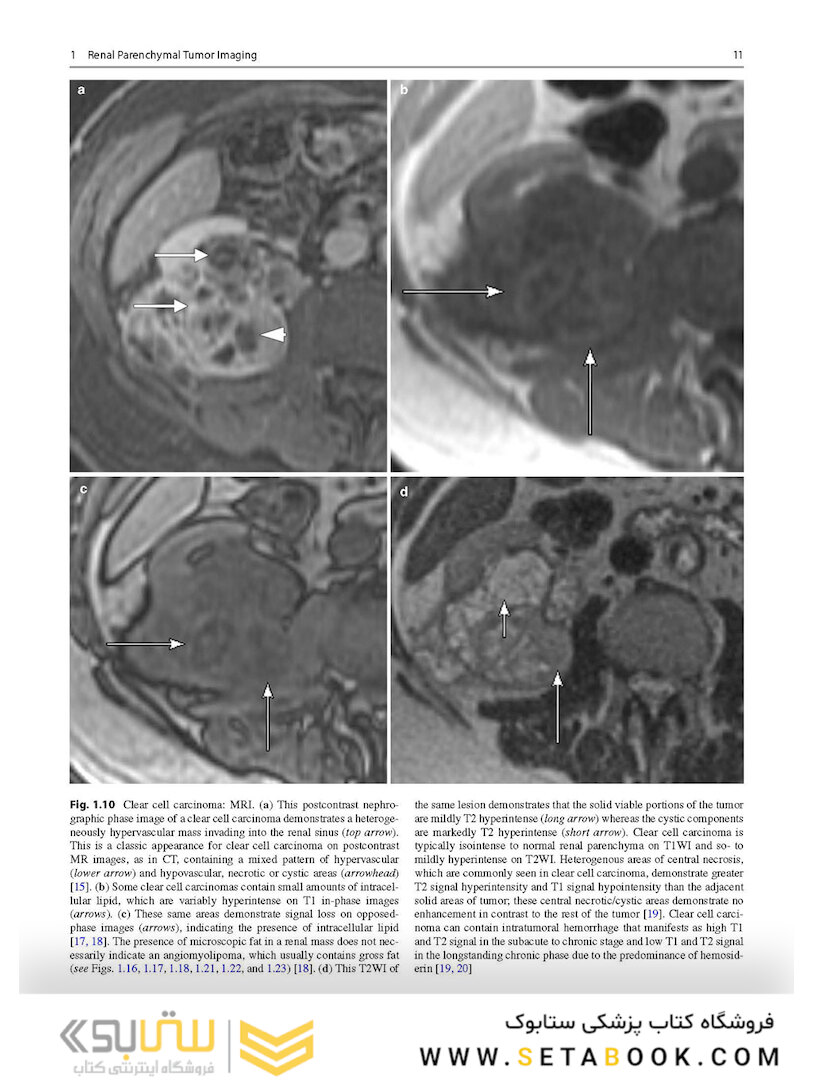 Atlas of Genitourinary Oncological Imaging