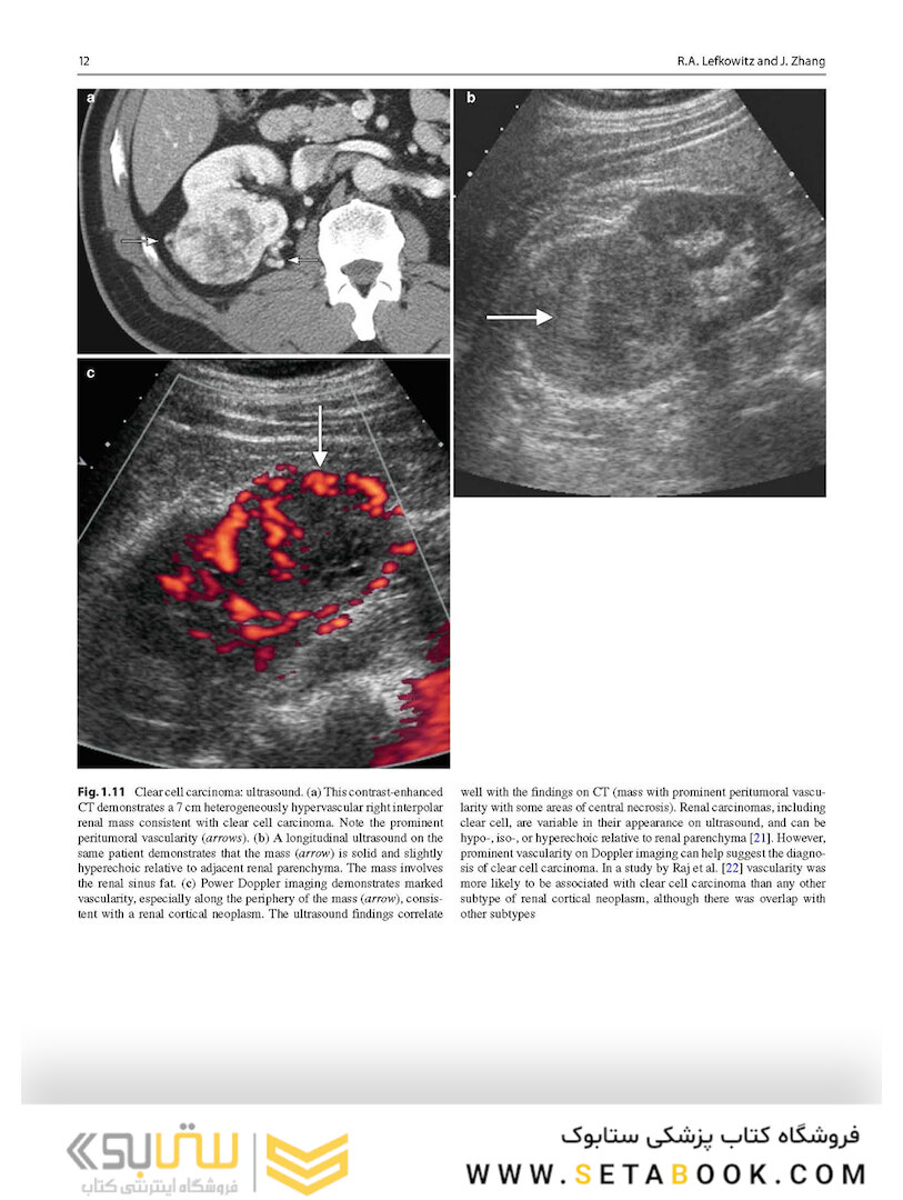 Atlas of Genitourinary Oncological Imaging