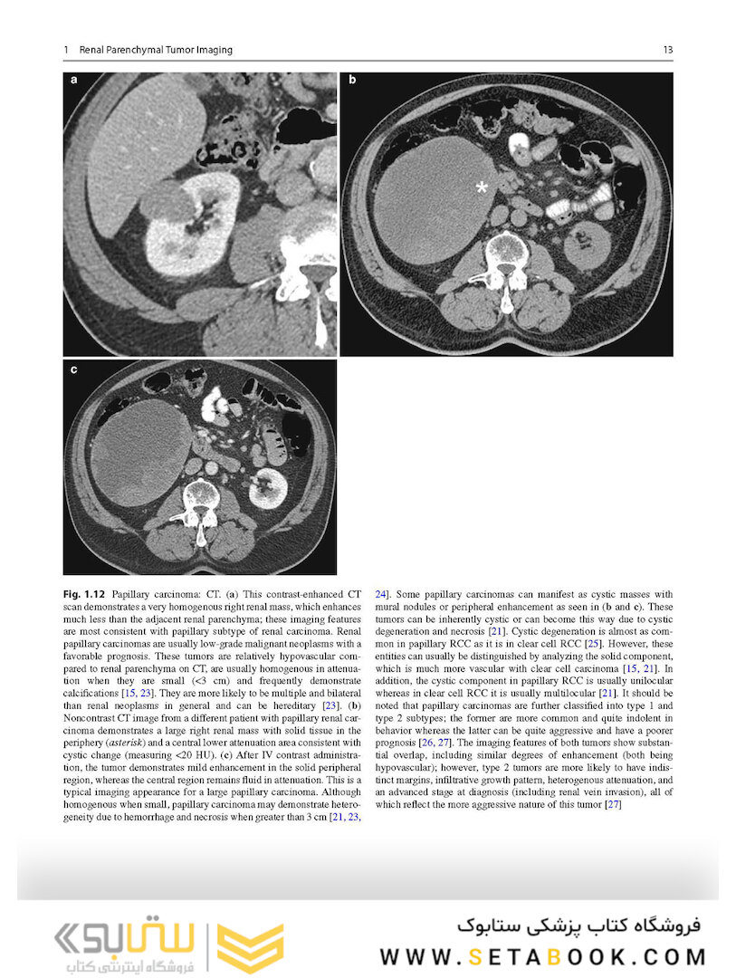 Atlas of Genitourinary Oncological Imaging