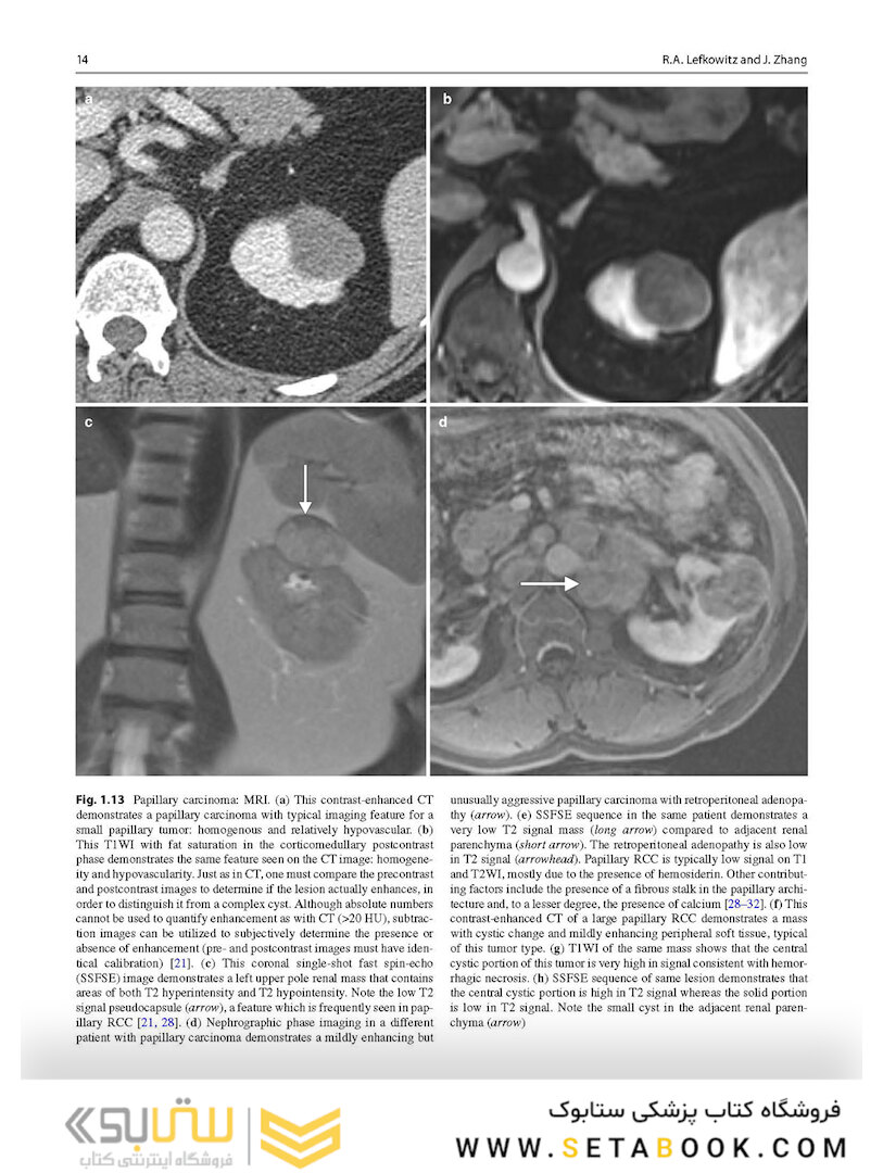 Atlas of Genitourinary Oncological Imaging