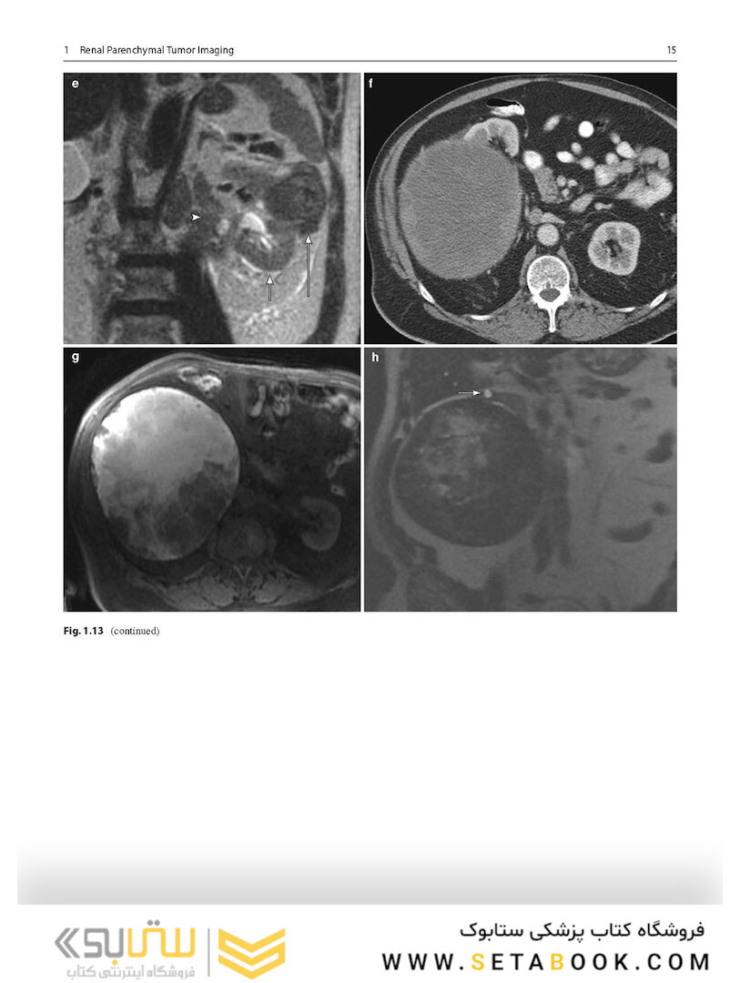 Atlas of Genitourinary Oncological Imaging