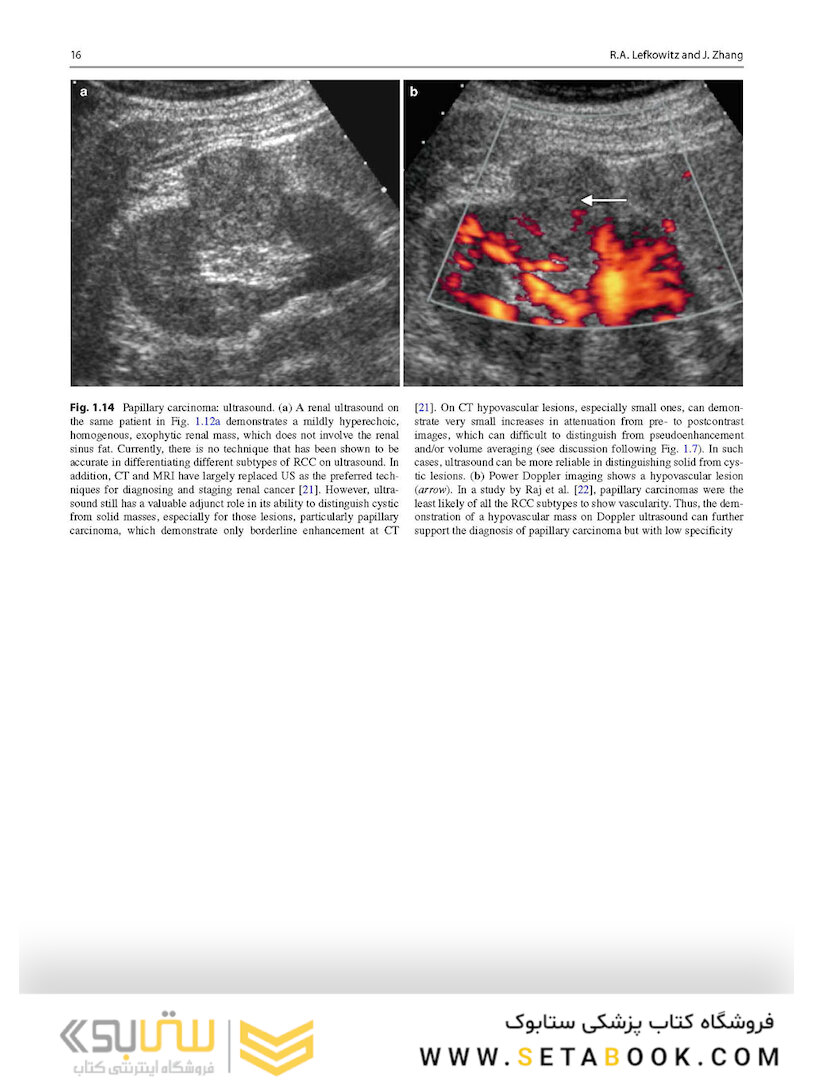 Atlas of Genitourinary Oncological Imaging