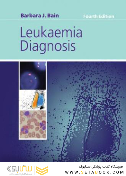 تشخیص سرطان خون