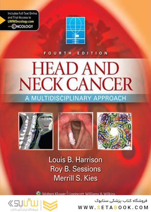 سرطان سر و گردن