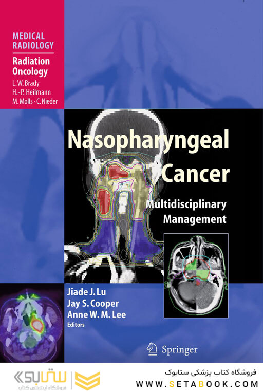 Nasopharyngeal Cancer : Multidisciplinary Management