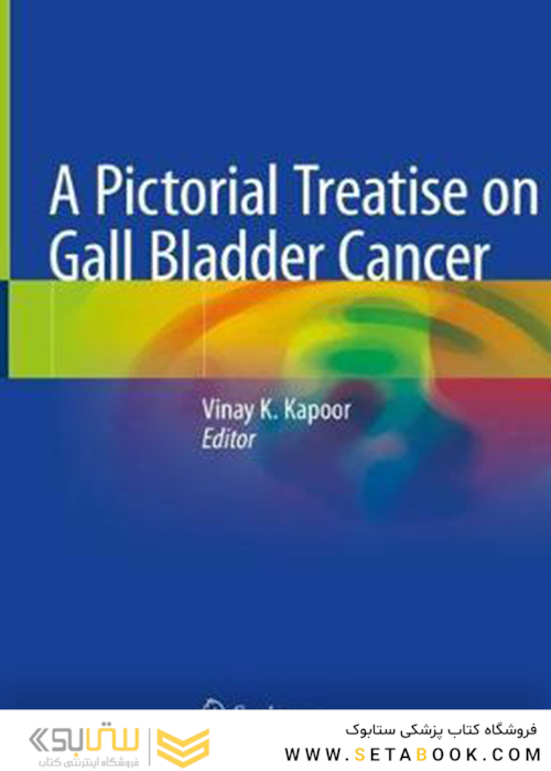 رساله تصویری درباره سرطان کیسه صفرا