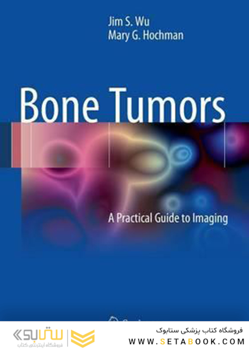 تومورهای استخوانی
