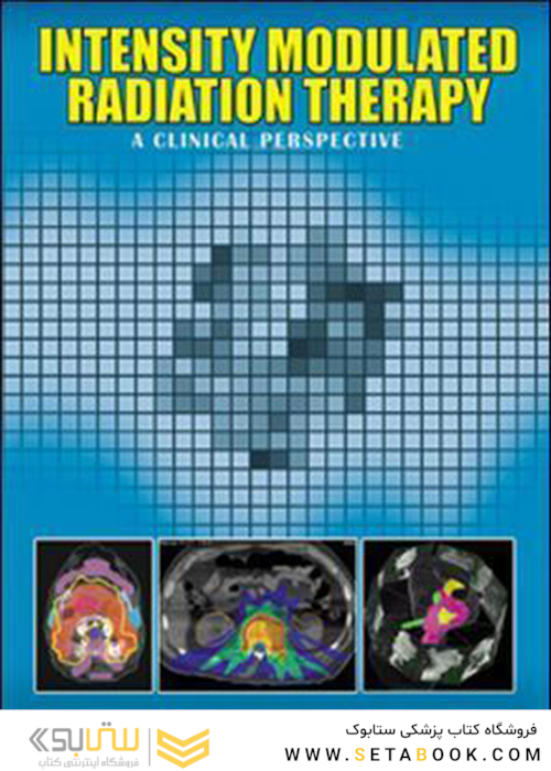 پرتودرمانی تعدیل شدت