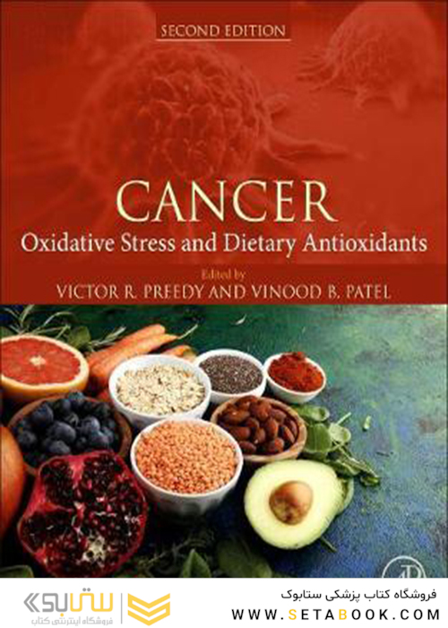سرطان: استرس اکسیداتیو و آنتی اکسیدان های رژیمی