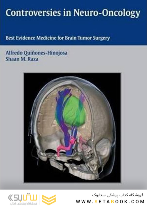 مناقشه در نورو انکولوژی