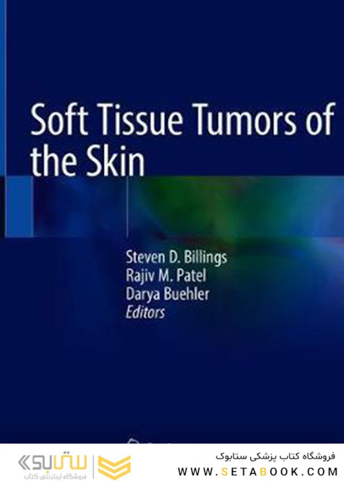 تومورهای بافت نرم پوست