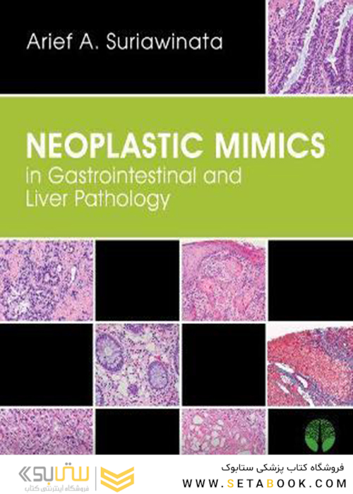 تقلید نئوپلاستی در آسیب شناسی دستگاه گوارش و کبد