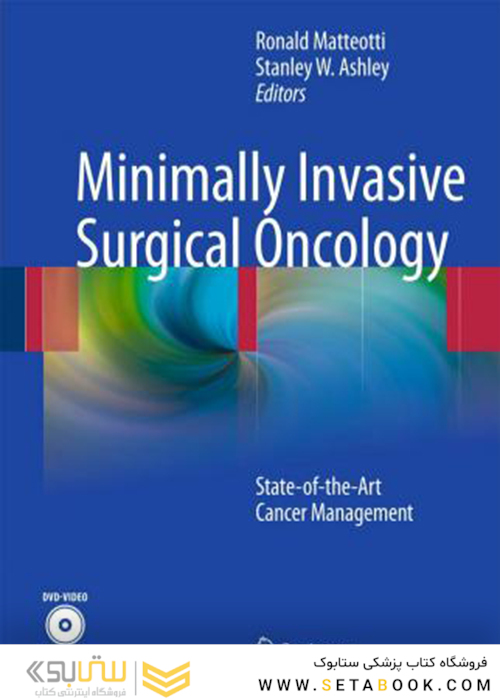 انکولوژی جراحی حداقل تهاجمی