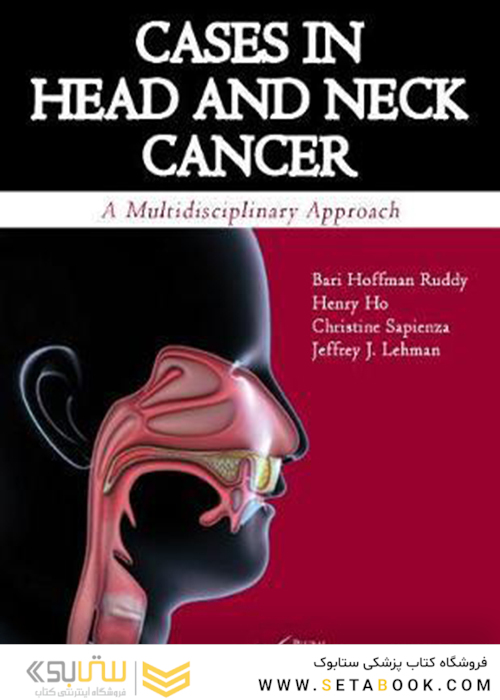 موارد سرطان سر و گردن