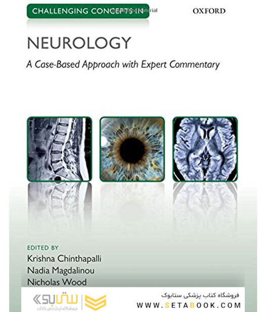Challenging Concepts in Neurology : Cases with Expert Commentary